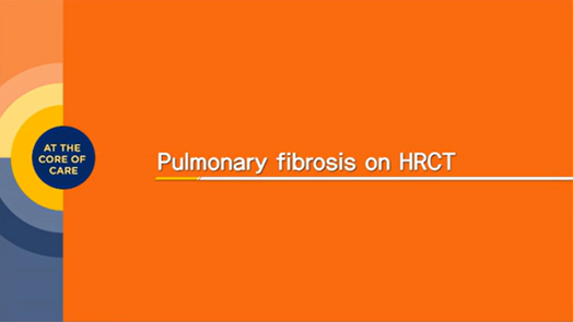 Radiologist's lecture for ILD : Part 3