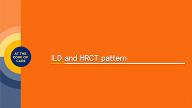 Radiologist's lecture for ILD : Part 2
