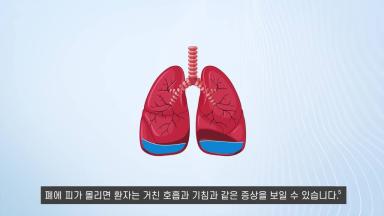 F.A.C.E.S - 5 signals on early detection of heart failure